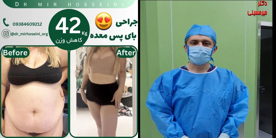 دکتر محسن میر حسینی- بهترین جراح بای پس معده در تهران