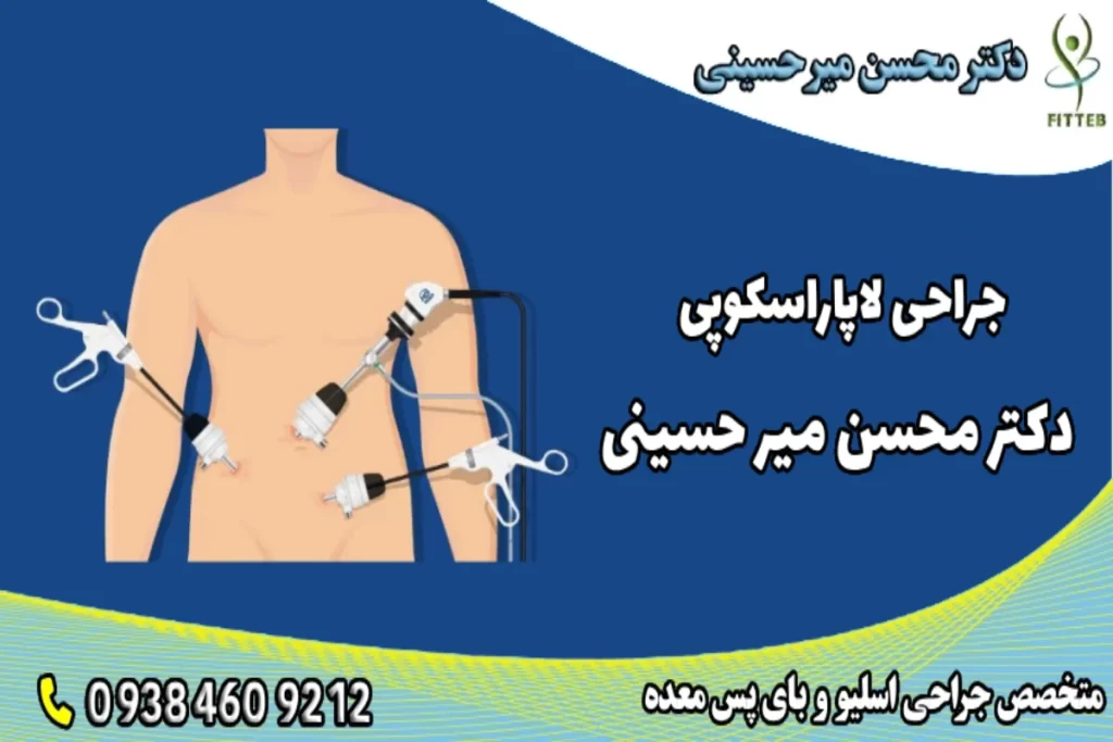 جراحی لاپاراسکوپی- دکتر محسن میر حسینی