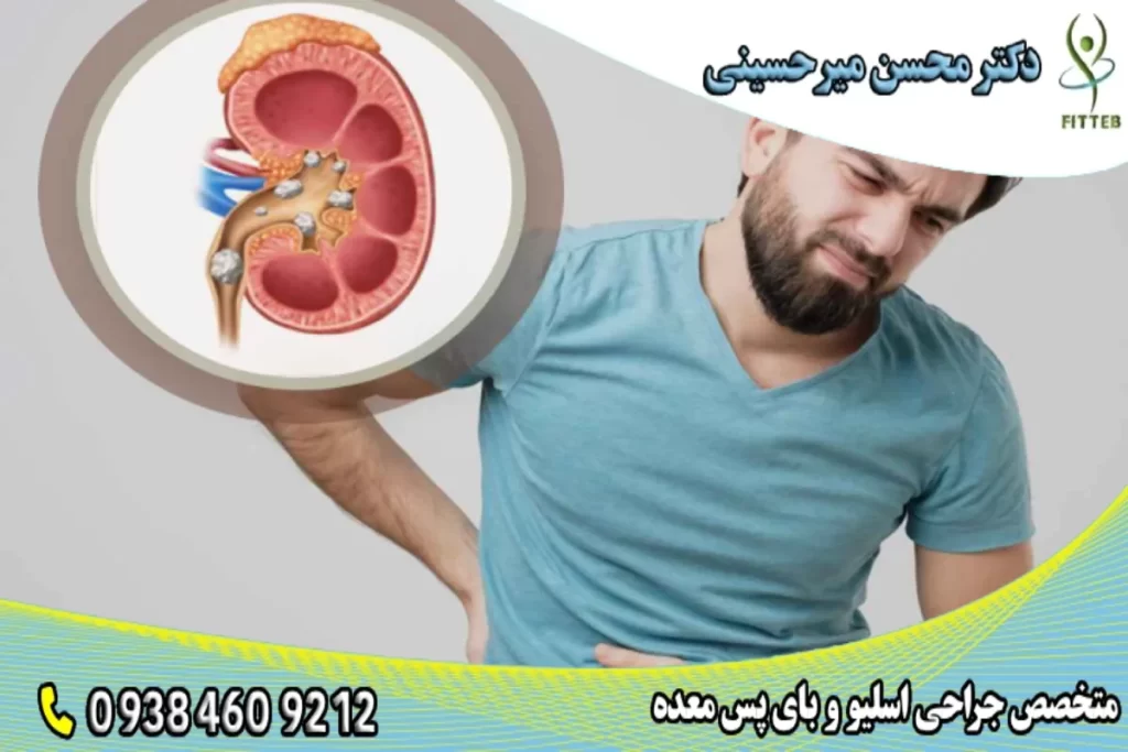 ارتباط سنگ کلیه و جراحی لاغری - دکتر محسن میر حسینی