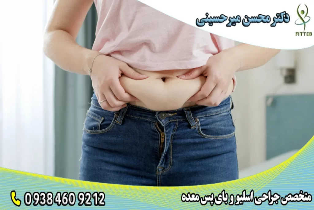 چاقی شکمی - دکتر محسن میر حسینی